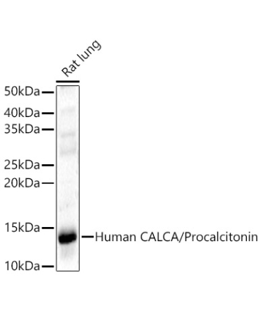 CALCA Rabbit Polyclonal Antibody