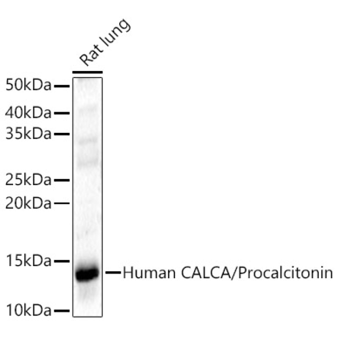 CALCA Rabbit Polyclonal Antibody