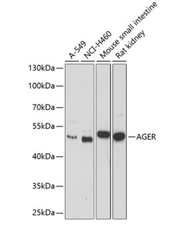 AGER Rabbit Polyclonal Antibody