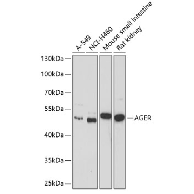 AGER Rabbit Polyclonal Antibody