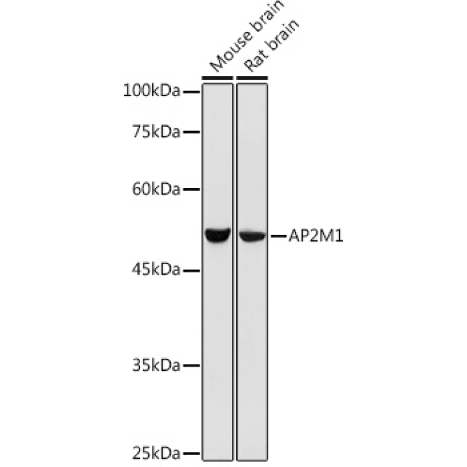 AP2M1 Rabbit Polyclonal Antibody