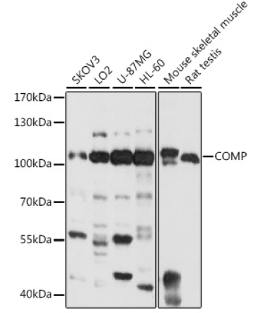 COMP Rabbit Polyclonal Antibody