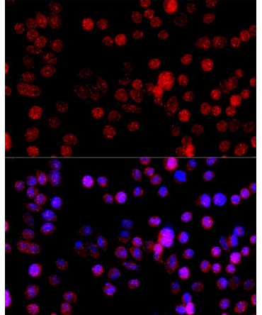 CYP1B1 Rabbit Polyclonal Antibody