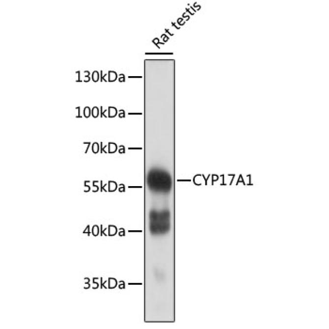 CYP17A1 Rabbit Polyclonal Antibody