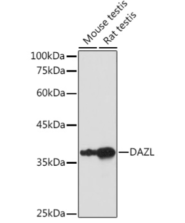 DAZL Rabbit Polyclonal Antibody