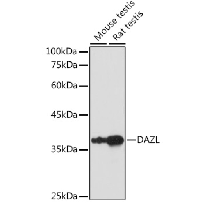 DAZL Rabbit Polyclonal Antibody