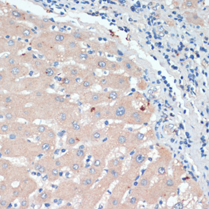 DBH Rabbit Polyclonal Antibody