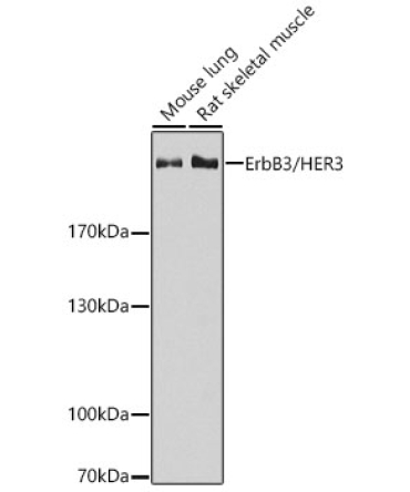 ErbB3/HER3 Rabbit Polyclonal Antibody
