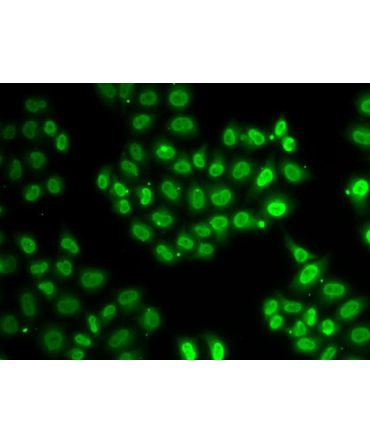 EWSR1 Rabbit Polyclonal Antibody