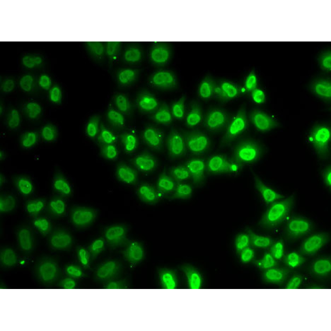 EWSR1 Rabbit Polyclonal Antibody