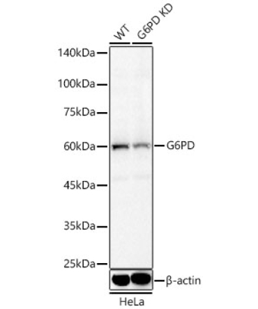 G6PD Rabbit Polyclonal Antibody