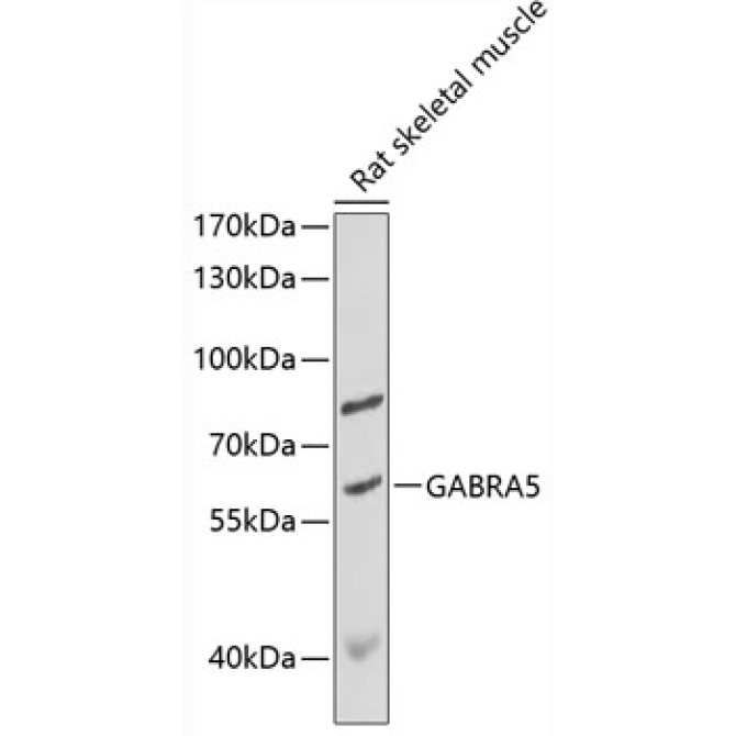 GABRA5 Rabbit Polyclonal Antibody