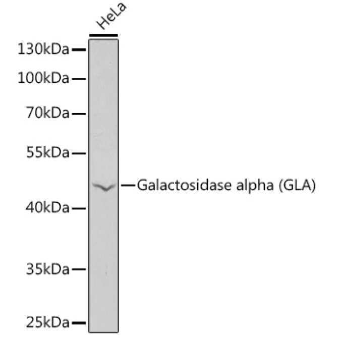 Galactosidase alpha (GLA) Rabbit Polyclonal Antibody
