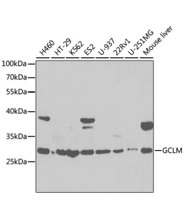 GCLM Rabbit Polyclonal Antibody