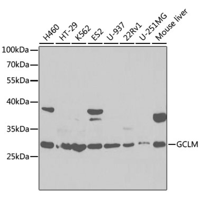 GCLM Rabbit Polyclonal Antibody