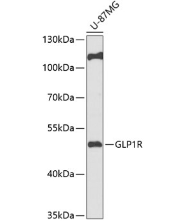 GLP1R Rabbit Polyclonal Antibody