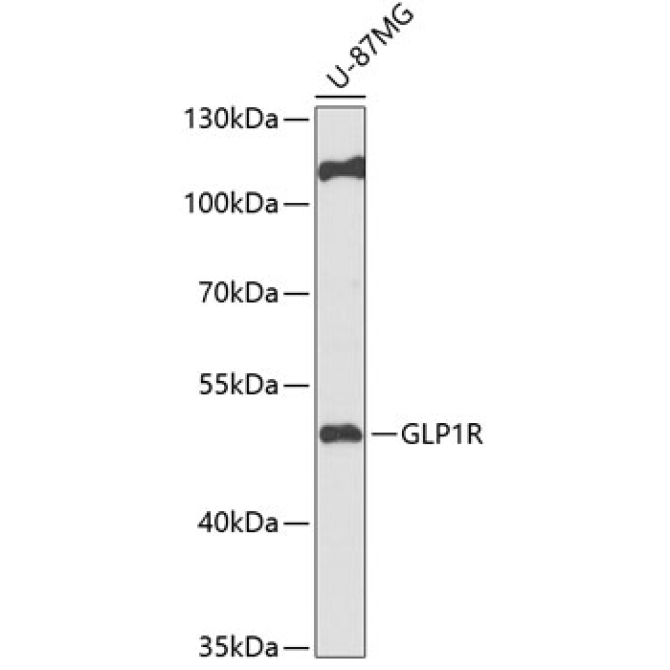 GLP1R Rabbit Polyclonal Antibody
