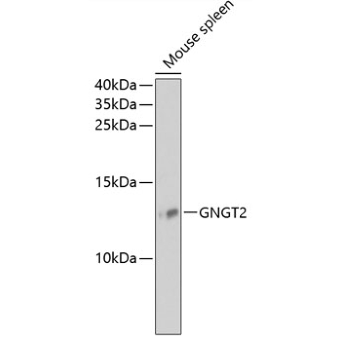 GNGT2 Rabbit Polyclonal Antibody