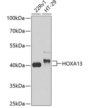 HOXA13 Rabbit Polyclonal Antibody