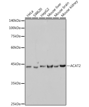 ACAT2 Rabbit Monoclonal Antibody