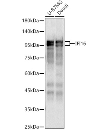 IFI16 Rabbit Polyclonal Antibody