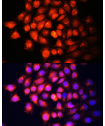 IGF2 Rabbit Polyclonal Antibody