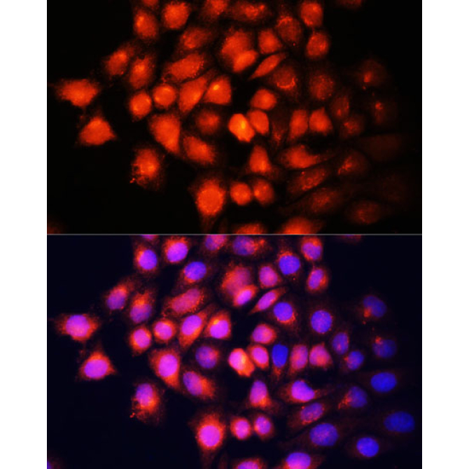 IGF2 Rabbit Polyclonal Antibody