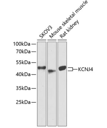 KCNJ4 Rabbit Polyclonal Antibody