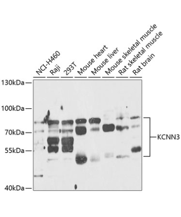 KCNN3 Rabbit Polyclonal Antibody