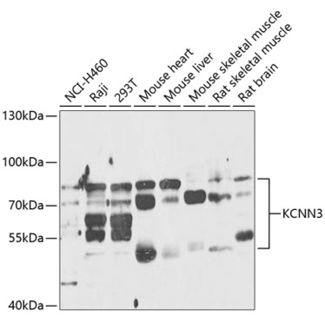 KCNN3 Rabbit Polyclonal Antibody