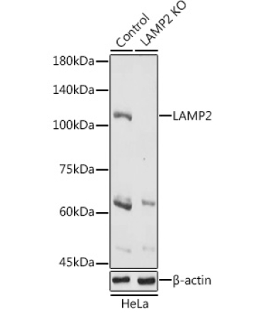 LAMP2 Rabbit Polyclonal Antibody [KO Validated]