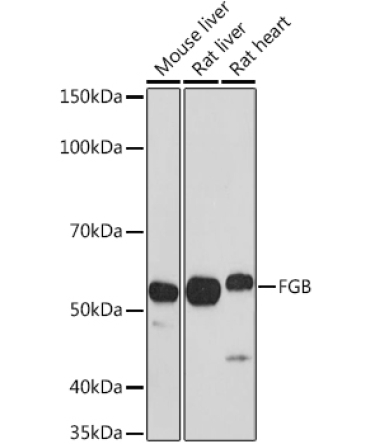 FGB Rabbit Polyclonal Antibody