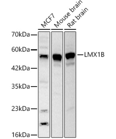 LMX1B Rabbit Polyclonal Antibody