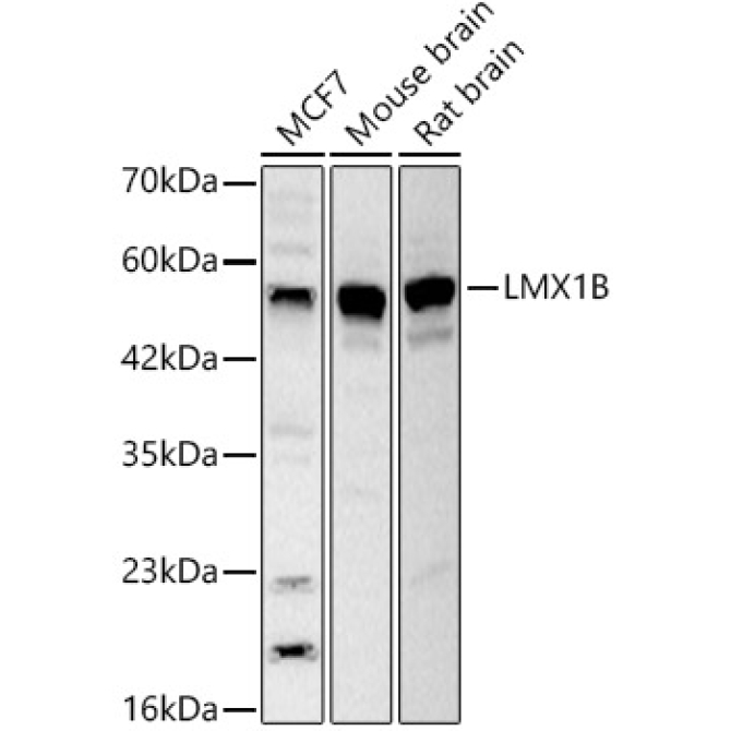 LMX1B Rabbit Polyclonal Antibody