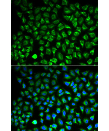 Monoamine Oxidase A (MAOA) Rabbit Polyclonal Antibody