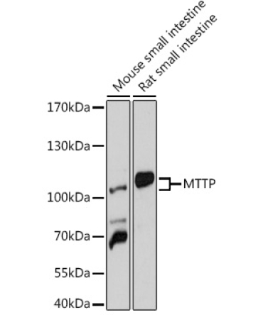 MTTP Rabbit Polyclonal Antibody
