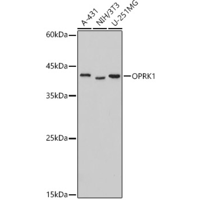 OPRK1 Rabbit Polyclonal Antibody