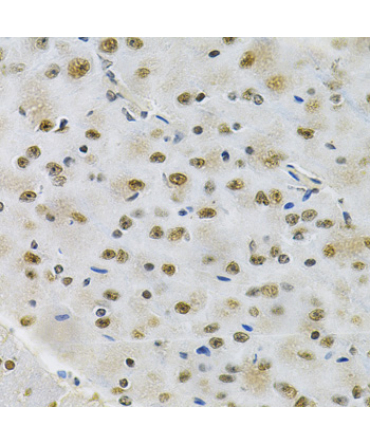 OTX2 Rabbit Polyclonal Antibody