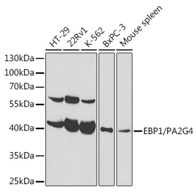 EBP1/PA2G4  Rabbit Polyclonal Antibody [KO Validated]