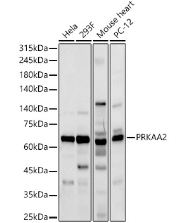 AMPKAlpha2 Rabbit Polyclonal Antibody