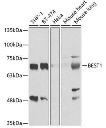 BEST1 Rabbit Polyclonal Antibody