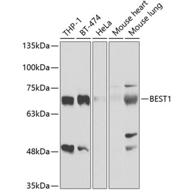 BEST1 Rabbit Polyclonal Antibody
