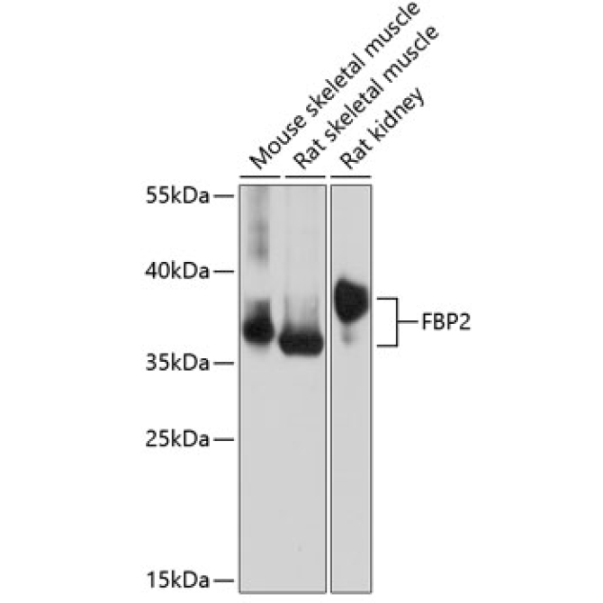 FBP2 Rabbit Polyclonal Antibody