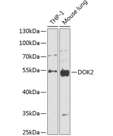 DOK2 Rabbit Polyclonal Antibody