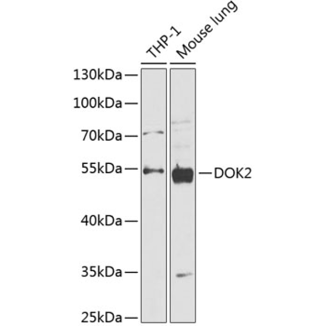 DOK2 Rabbit Polyclonal Antibody