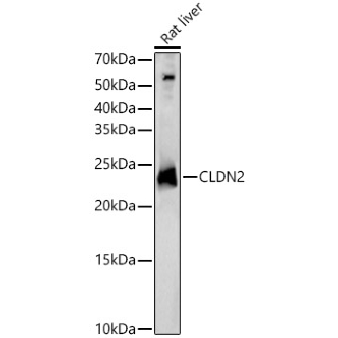 CLDN2 Rabbit Polyclonal Antibody