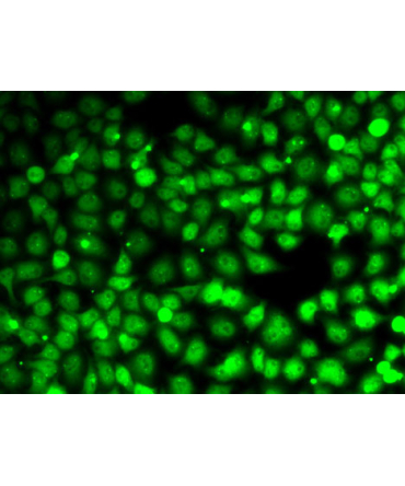 Cyclin E2 Rabbit Polyclonal Antibody
