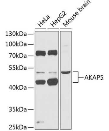 AKAP5 Rabbit Polyclonal Antibody