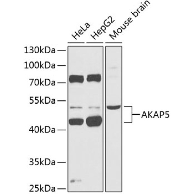 AKAP5 Rabbit Polyclonal Antibody