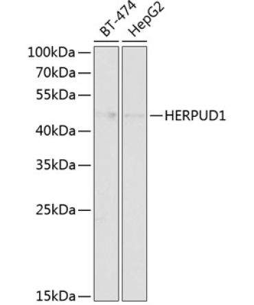 HERPUD1 Rabbit Polyclonal Antibody